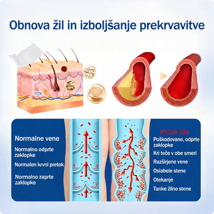 ✨🌿 Medistart® mikroneedling obliž za nego krčnih žil ⚡ Takojšnje olajšanje, dolgotrajni rezultati