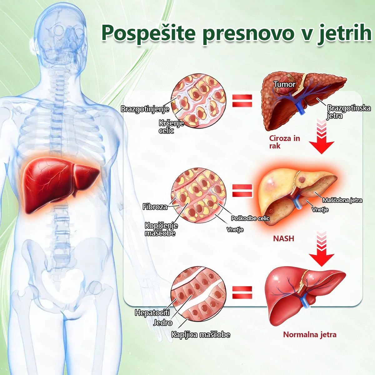 Registrirano pri JAZMP in GMP certificirano👩‍⚕️🎁 𝐆𝐞𝑒𝐿𝑒𝐦𝐨𝐧® 𝐆𝐥𝐮𝐦𝐚𝐬𝐞𝐭𝐢𝐝𝐞 8 v 1 Hujševalni in zdravju namenjen nano obliž z mikroiglicami 8.🇸🇮 (Samo enkrat na dan, vidne spremembe že v 7 dneh)