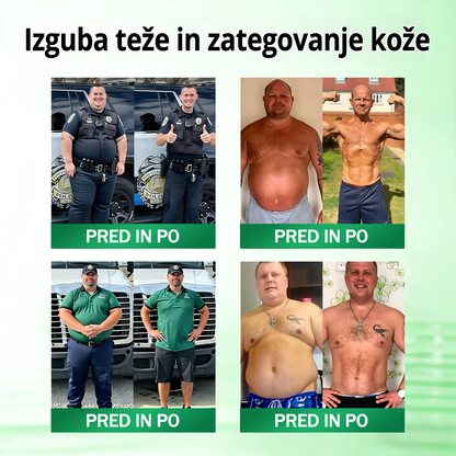 Registrirano pri JAZMP in GMP certificirano👩‍⚕️🎁 𝐆𝐞𝑒𝐿𝑒𝐦𝐨𝐧® 𝐆𝐥𝐮𝐦𝐚𝐬𝐞𝐭𝐢𝐝𝐞 8 v 1 Hujševalni in zdravju namenjen nano obliž z mikroiglicami 8.🇸🇮 (Samo enkrat na dan, vidne spremembe že v 7 dneh)