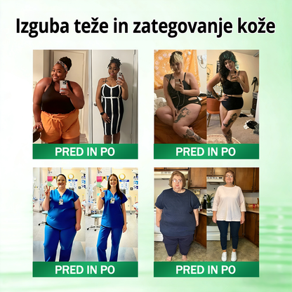 Registrirano pri JAZMP in GMP certificirano👩‍⚕️🎁 𝐆𝐞𝑒𝐿𝑒𝐦𝐨𝐧® 𝐆𝐥𝐮𝐦𝐚𝐬𝐞𝐭𝐢𝐝𝐞 8 v 1 Hujševalni in zdravju namenjen nano obliž z mikroiglicami 8.🇸🇮 (Samo enkrat na dan, vidne spremembe že v 7 dneh)