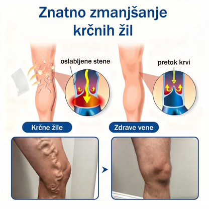 ✨🌿 Medistart® mikroneedling obliž za nego krčnih žil ⚡ Takojšnje olajšanje, dolgotrajni rezultati