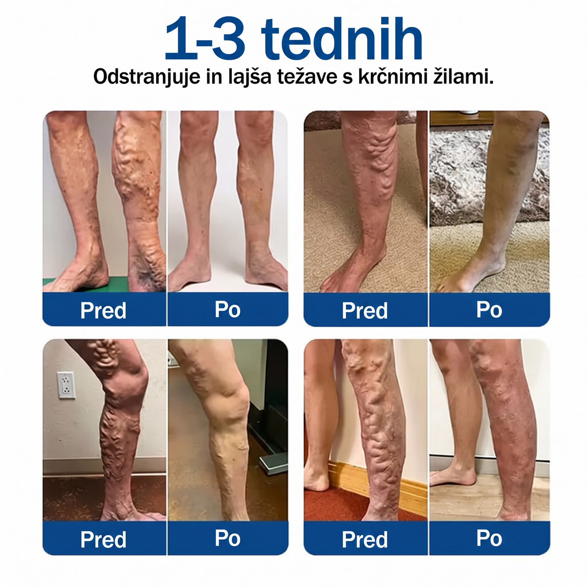 ✨🌿 Medistart® mikroneedling obliž za nego krčnih žil ⚡ Takojšnje olajšanje, dolgotrajni rezultati
